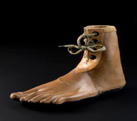 The Jaipur Foot (Sethi and Sharma)